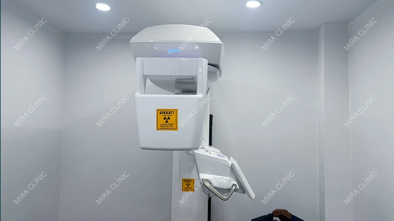 CBCT scan